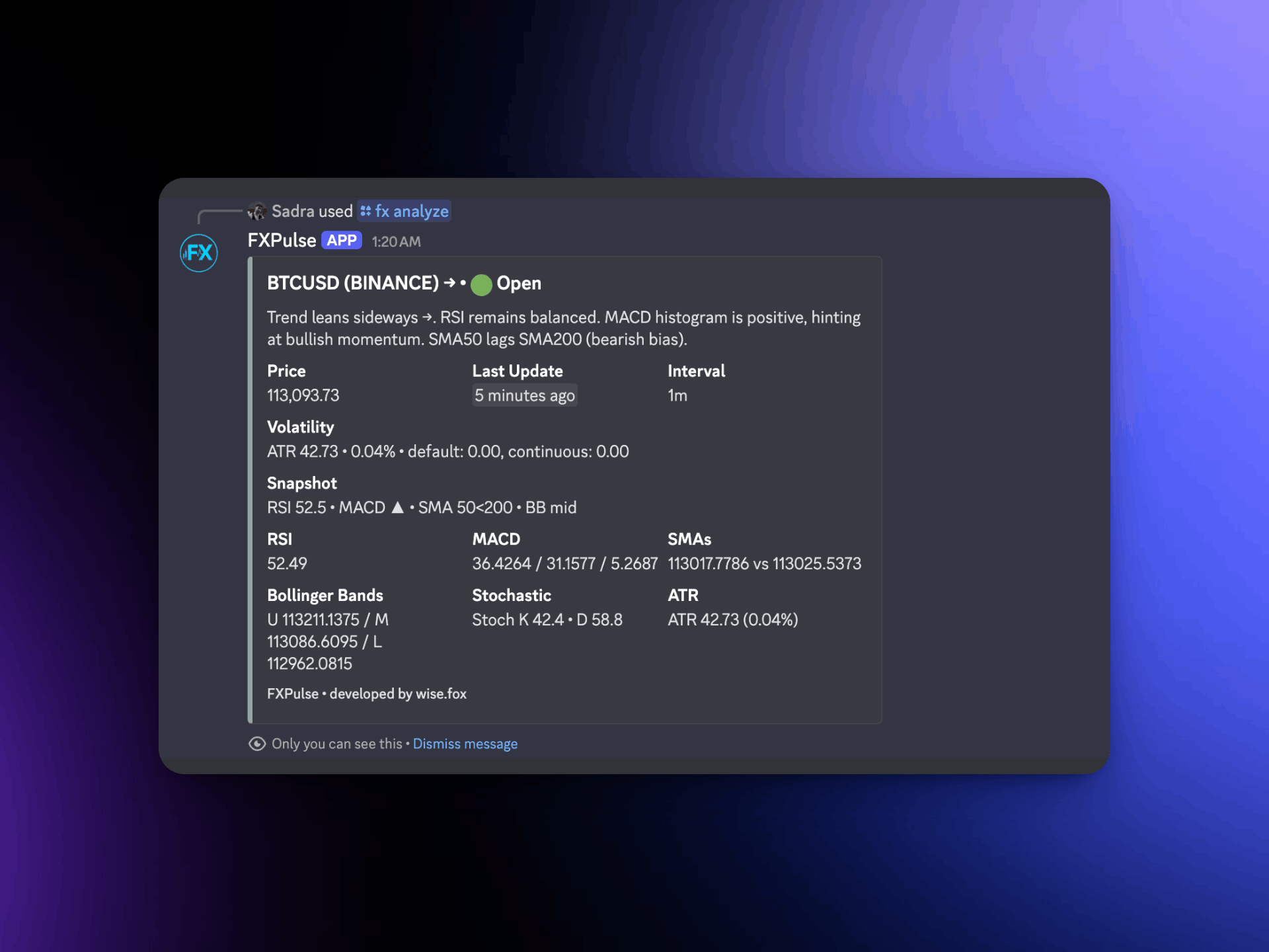 FXPulse Discord Bot preview 2